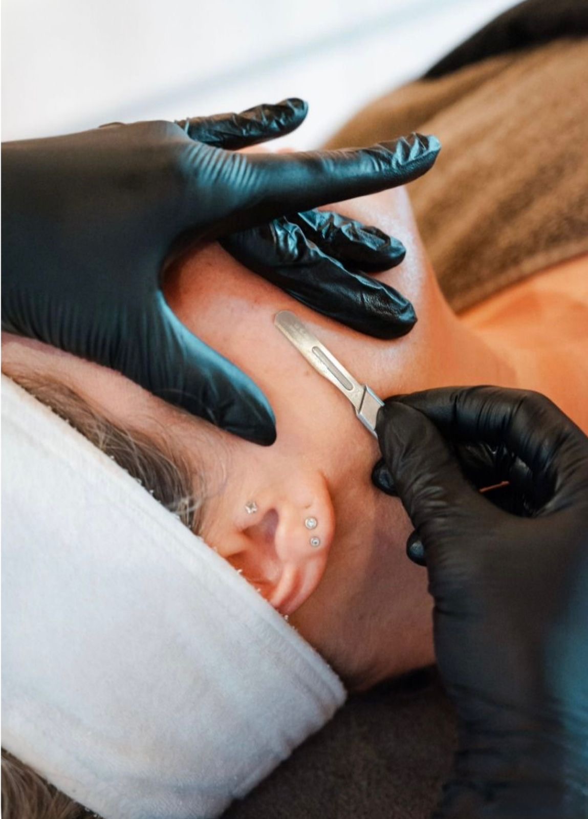 Dermaplaning
